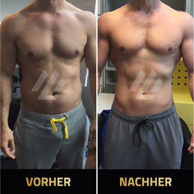 Testimonial - Vorher-Nachher-Bild